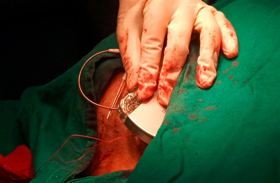 Primera_Cirugía_Cardiovascular_en_Pinar_del_Río (2)